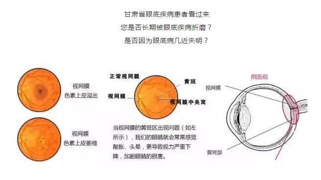 9月1日廣州中山大學眼科教授張少沖來蘭會診